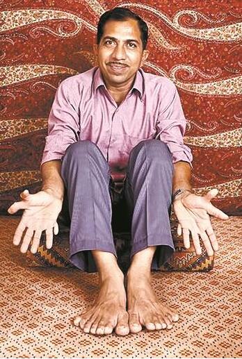 世界上脚趾最多的人，印度小男孩脚趾数量多达20根