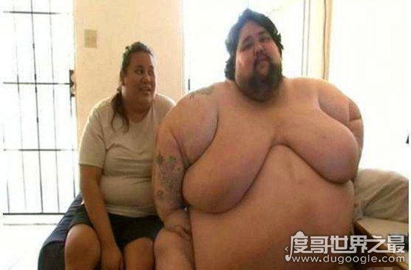 曾经的世界最胖男子，里基·纳普提重800斤(绝望自杀而死)
