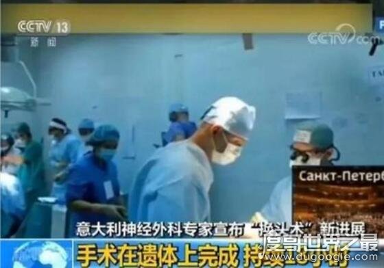 世界首例换头手术成功了吗，在中国取得成功(耗时18小时花费7千万)