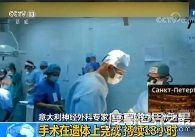 世界首例换头手术成功了吗，在中国取得成功(耗时18小时花费7千万)