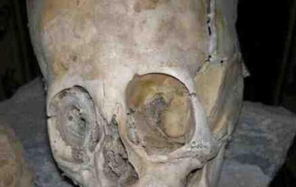 巨头干尸是什么：疑似外星人的干尸，头骨比人类大很多