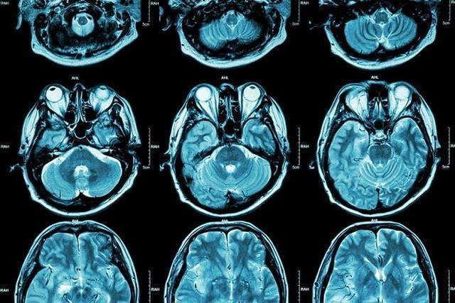 科学家称人类大脑有着惊人的860亿个神经元