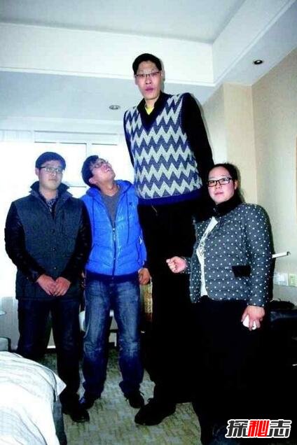 亚洲第一高人，张俊才身高2.42米(结婚18年不要孩子)