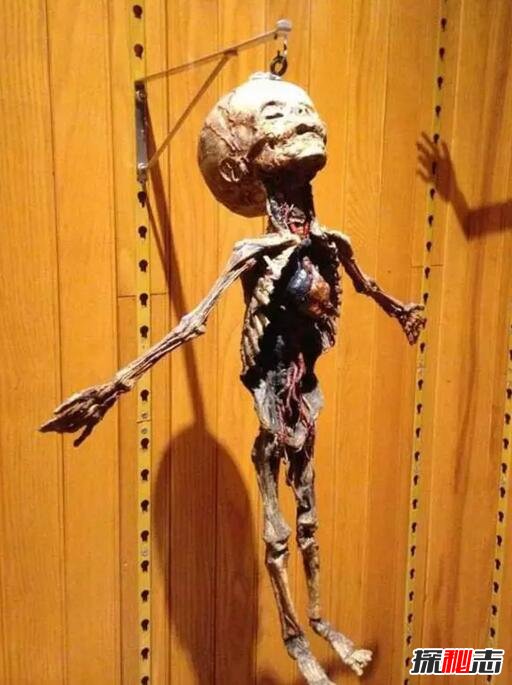 世界上最恐怖的博物馆，美国费城马特博物馆(尸骨成堆)