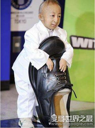 中国第一袖珍人，何平平身高74.61cm(出生时仅1斤重)