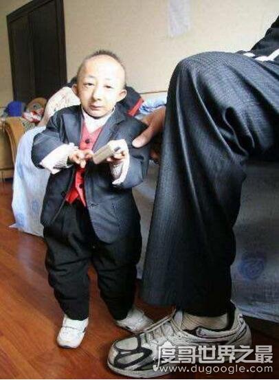 中国第一袖珍人，何平平身高74.61cm(出生时仅1斤重)