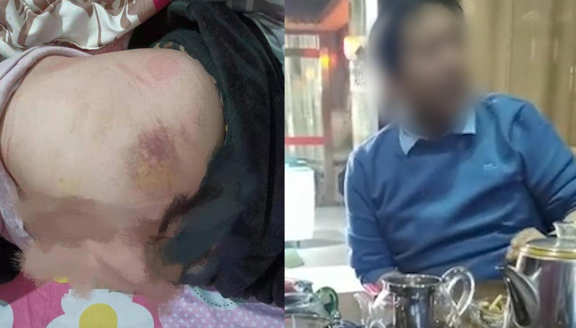 广东揭阳姐弟被继母殴打 连续七年体无完肤（家庭暴力）