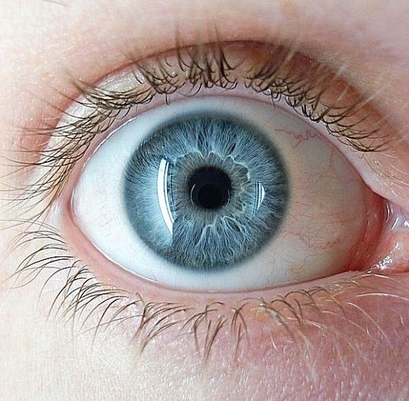 琥珀色的瞳孔存在吗，瞳孔变色意味着疾病（影响很大）
