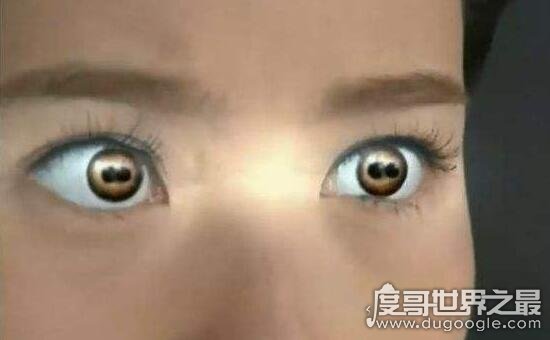 重瞳子就是有两个瞳孔的人，古代的帝王之相实际是病症
