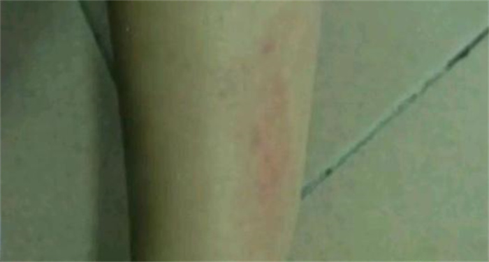 武汉的五岁女孩儿 被老师打八分钟巴掌（虐待儿童）