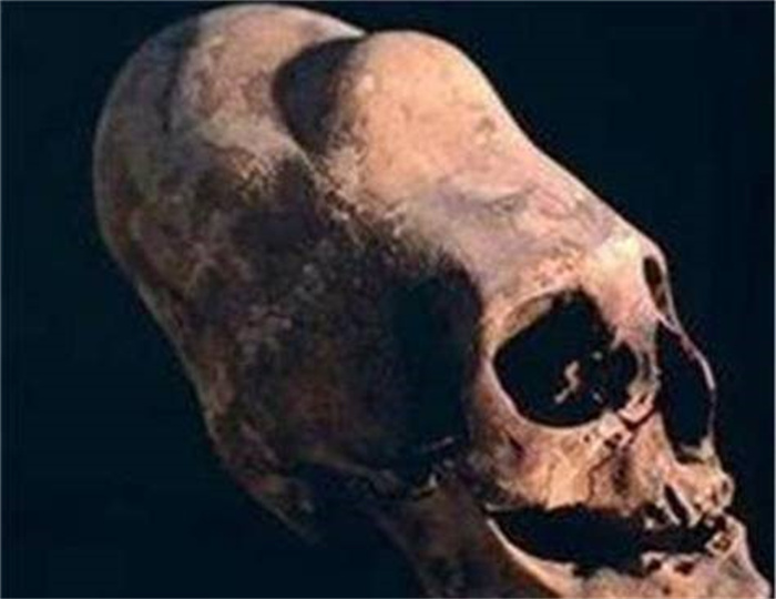 “异形头骨”被发现，一半DNA不属于人类，是史前文明还是外星人
