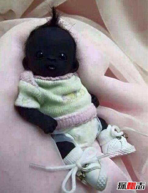 世界上最黑的孩子，眼珠都黑成碳了(长大图片曝光)