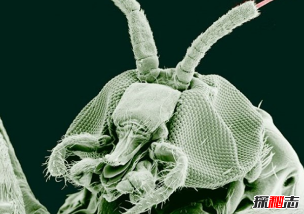 人体寄生虫有哪些种类?寄生虫对人体的十大危害