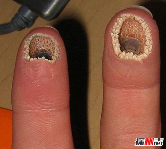 超恶心的空手指是什么，将七鳃鳗嘴巴P在手指上的恶搞图片