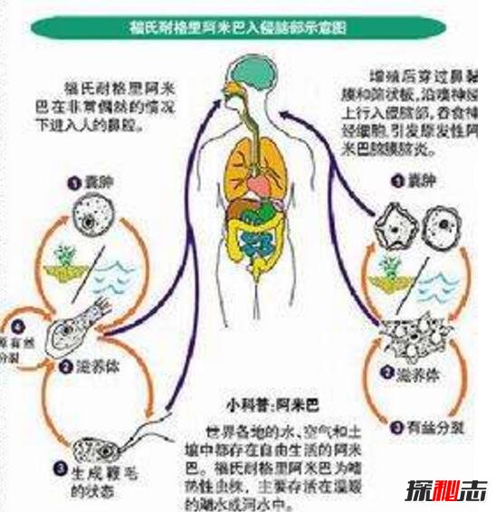 福氏耐格里变形虫真可怕，一步步慢慢吃掉你的大脑致死