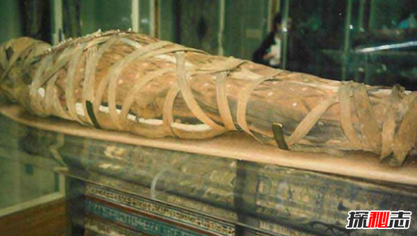 历史上最疯狂的十大医疗案例,死鼠膏在古埃及用于治疗牙痛