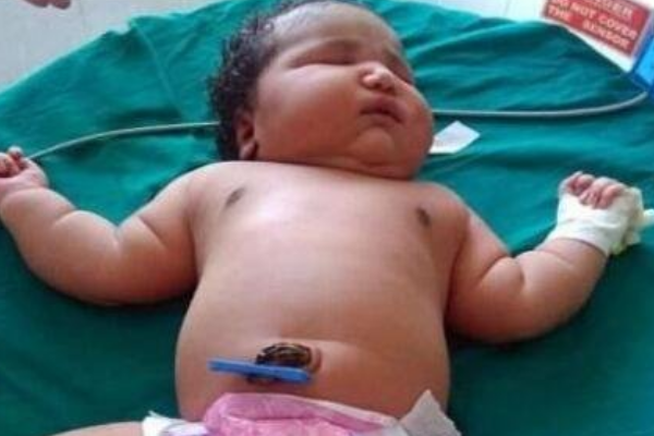 世界上最重的女婴:出生体重达13.6斤(等于普通宝宝2倍)
