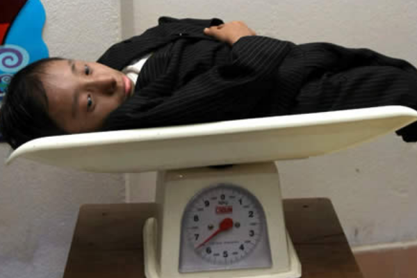 世界上体重最轻的人:成年体重仅5.45公斤(出生仅600克)
