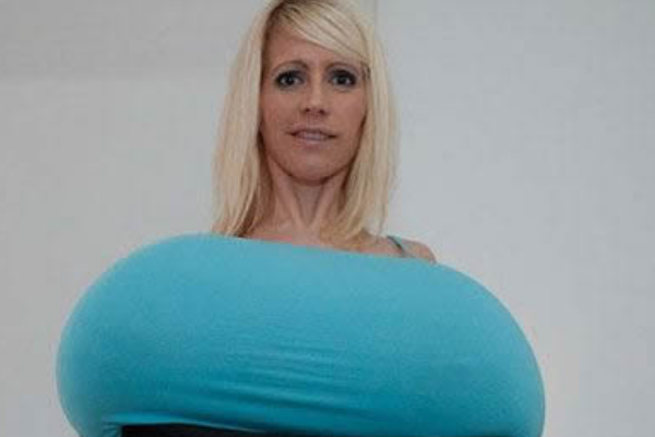 世界上最大的乳房:胸围154厘米(每个乳房重9公斤)