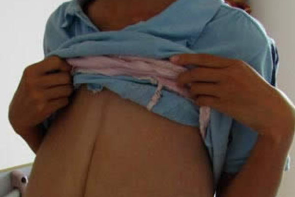 世界上乳房下垂最严重的女人:掉到腰部(像泄气的皮球)