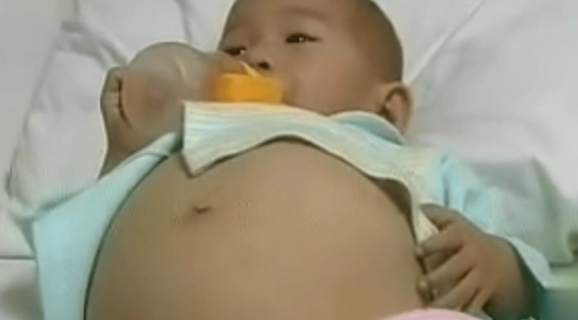 嗯河南一岁半的小女孩离奇怀孕 居然还做了剖腹产手术