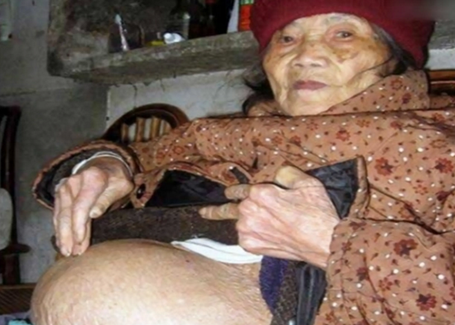 四川90岁老人怀孕 简直是医学奇迹（老人怀孕）