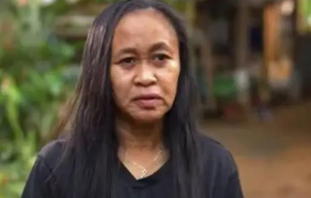 菲律宾16岁美女光速变老 早衰症居然如此可怕（奇怪病症）