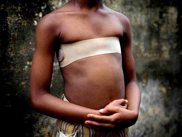 1000英国女孩被烫伤、400万非洲女性遭伤害，竟然是在保护自己？