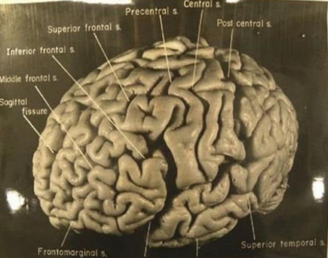 要是人类大脑可以用来储存，相当于多少g？（大脑容量）