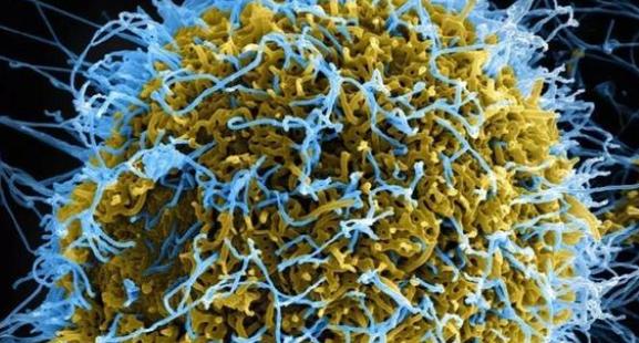 生存能力最强的几种病毒，埃博拉就是其中之一（强大病毒）