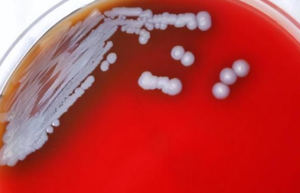 在美国发现了不明细菌，有超过一半的致死率（致命细菌）