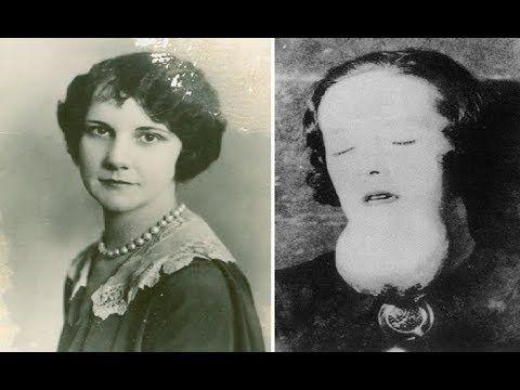 1921年，女孩们身体溃烂尸骨发光，却被美国公司诬陷为身患梅毒
