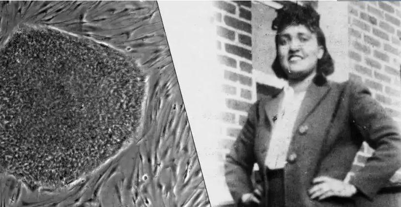 细胞之母死于70年前，细胞却不断繁衍，分裂达5000万吨