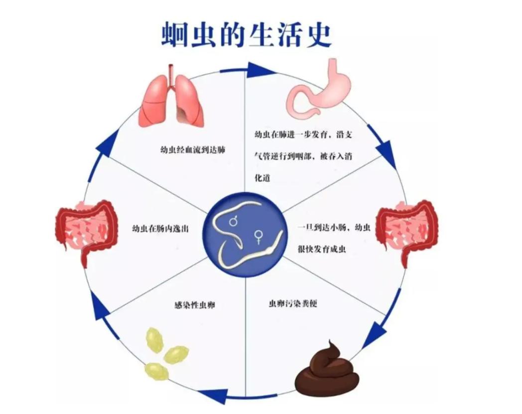 为何现在很少有人听说过蛔虫十几年前几乎人人肚子里都有过