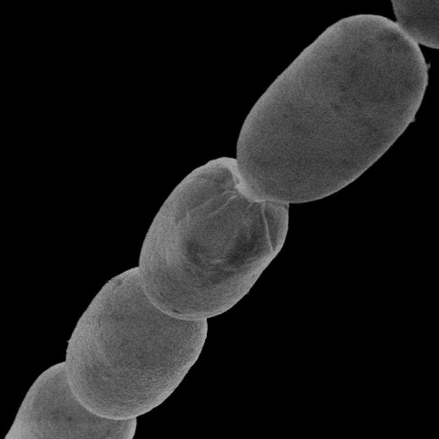 科学家发现史上最大细菌，长度达2厘米（微生物）