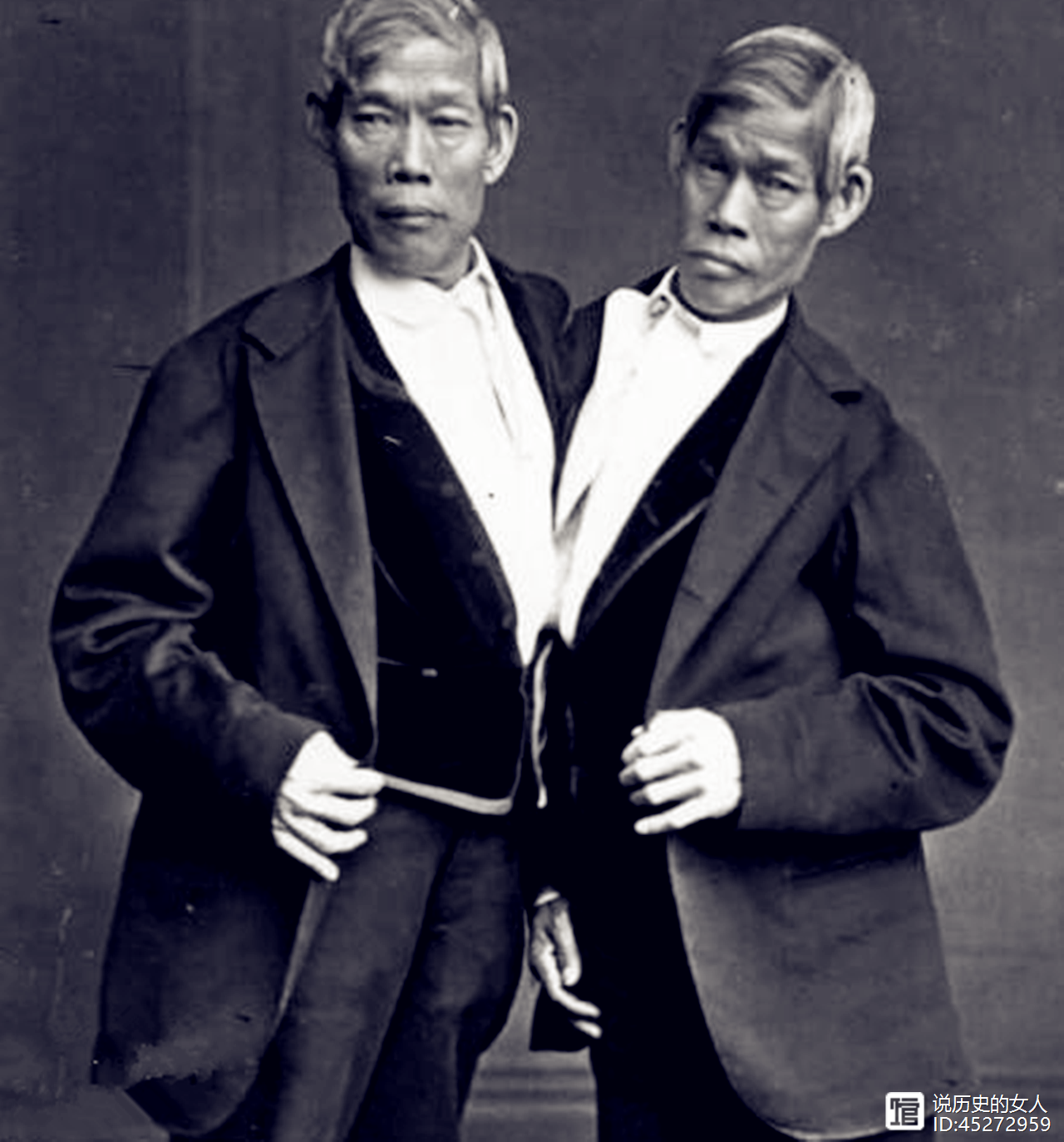 泰国双胞胎.png