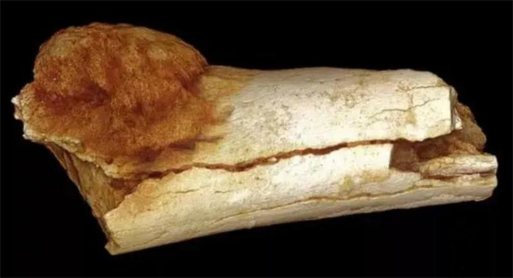 癌症居然有这么多年的历史 找到了病变的化石骨头（恐龙癌症）
