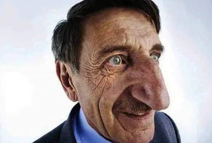 世界上鼻子最长的人 现在已经去世（最长鼻子）