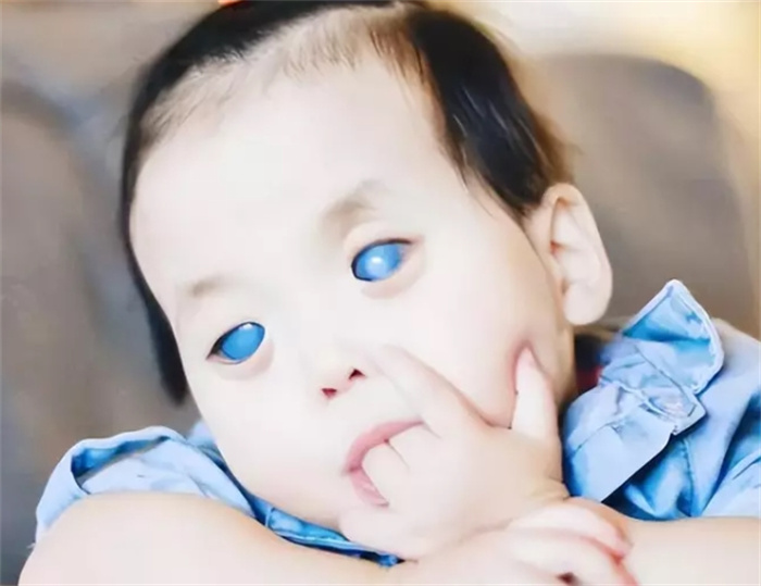 纪实“蓝眼睛”女孩一出生就被抛弃，被美国夫妇领养后，现状如何