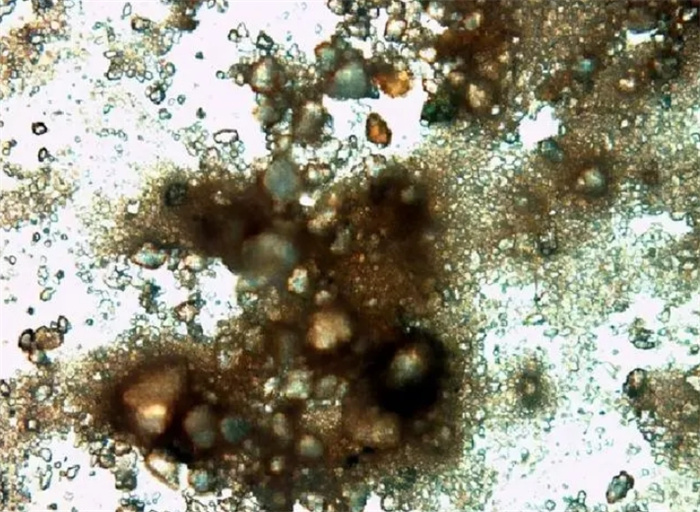 洗澡搓下来的泥里竟是有细菌？显微镜下惊人！