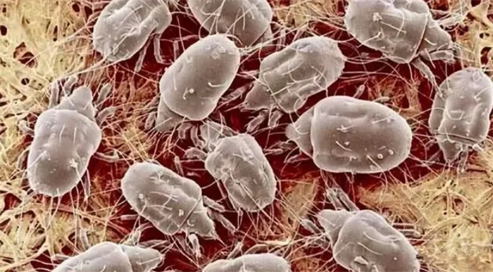洗澡搓下来的泥里竟是有细菌？显微镜下惊人！