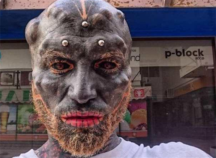 男子想变成外星人 在眼球上纹身 将假体植入头颅变成“怪物”