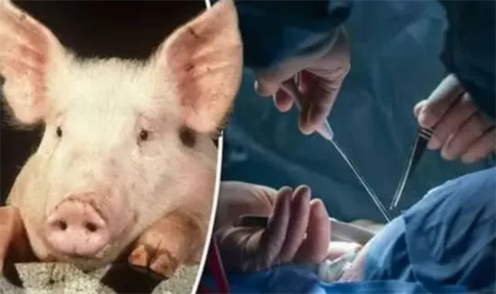 全球首例 美国一医院实现猪肾脏人体移植 尿毒症要有救了