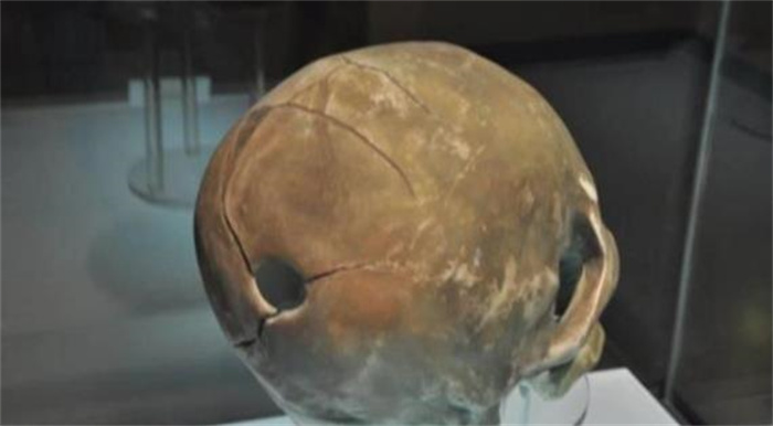 山东发现5000年前的遗址，居然有人在做开颅手术