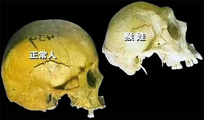 猴娃真是野人吗  1997年  专家对“猴娃”遗骨进行检测  结果如何