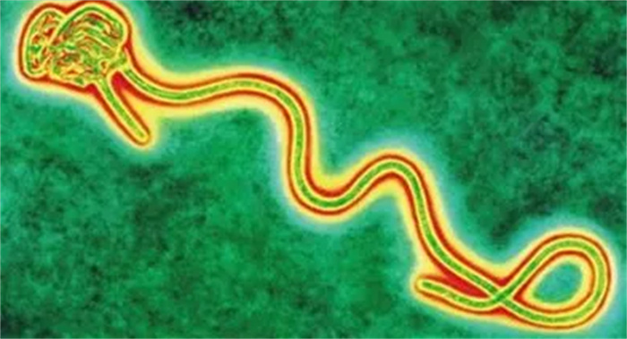世界上最强的病毒(埃博拉病毒)